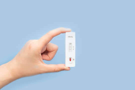 Hand holding Hepatitis B Virus Surface Antigen Test Kit with positive result on blue background. Screening for hepatitis B uses a blood sample, collected from a finger prick. World hepatitis day.