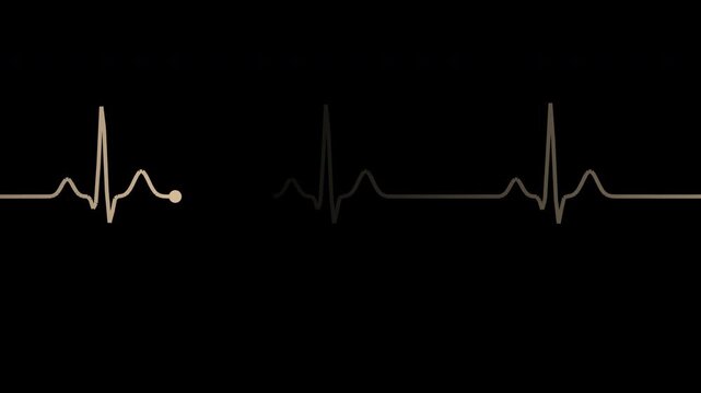 Beige heartbeat pulse line with monitor sweep effect, transparent background loop animation