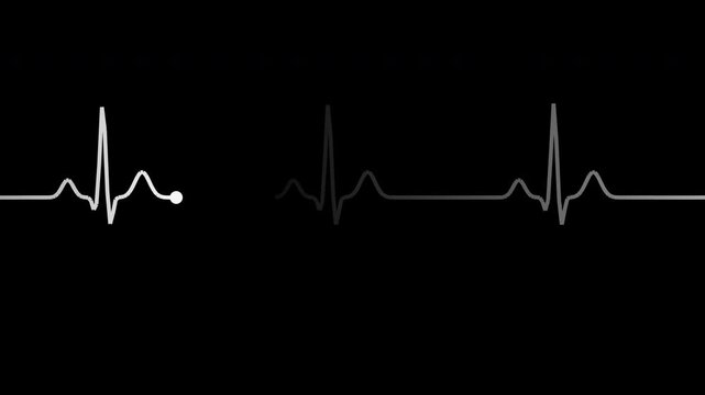 White heartbeat pulse line with monitor sweep effect, transparent background loop animation
