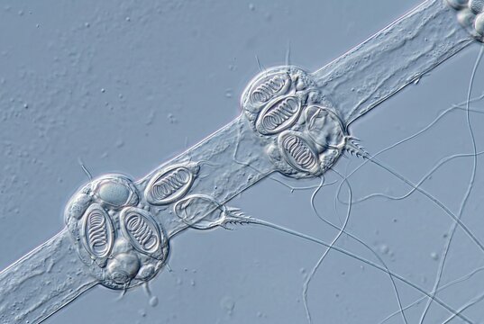 Microscopic DIC view of freshwater jellyfish tentacle showing undischarged and fired nematocyst batteries