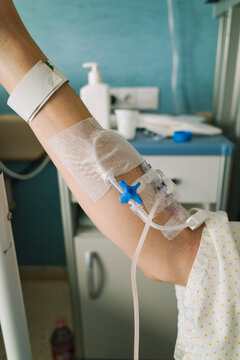 Intravenous Medical Access