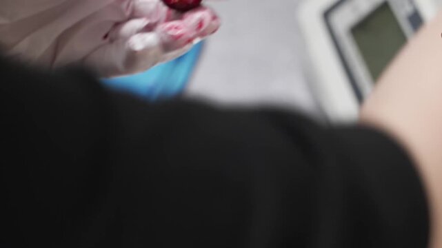 close-up shot featuring a person in white surgical gloves using medical instruments to perform a delicate "operation" on a dark red cherry. This footage illustrates precision, medical training, micros