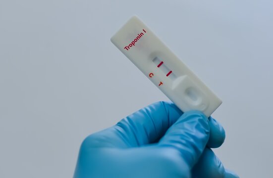 Blood sample of patient positive result for troponin I.