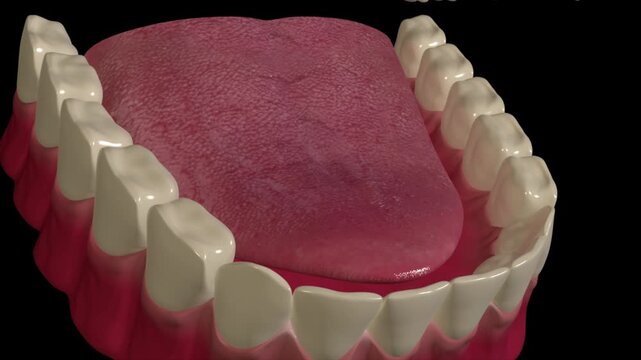 Tooth decay process: bacteria produce acid that demineralizes enamel, forming cavities over time. Close-up 3D rendering of caries development and progression.