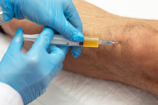 Joint plasma therapy. Doctor injects plasma into patient's knee. Patient's own biomaterial. Latest methods of joint treatment. Treatment of joint pain without surgery. Regeneration of cartilage