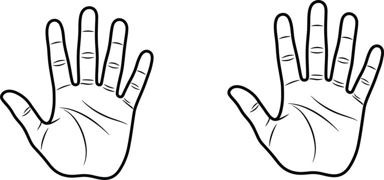 Human Hands with Six Fingers Polydactyly Medical Condition Outline Vector Illustration Set for Genetic Variations Anatomical Studies and Science Textbook Diagrams