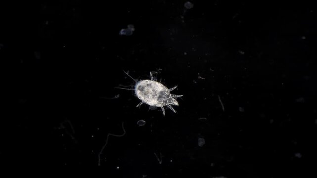 Dust mite under microscope at 100x magnification, darkfield microscopy view of house dust allergen