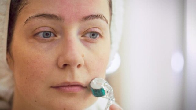 A girl gently rolls a derma roller across her face, using microneedling to boost collagen and smooth texture. The at-home skincare ritual feels like a professional facial, enhancing radiance