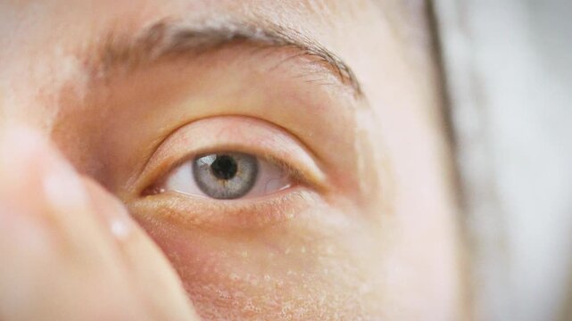 Girl gently massages a white cleansing foam onto her face, focusing on the delicate skin around and under the eye, illustrating a careful skincare routine that soothes and cleanses sensitive eye area