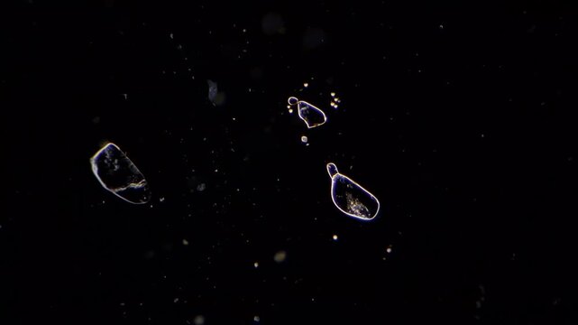 Salt crystals growing under microscope