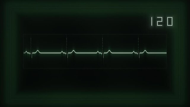 Heartbeat monitor display shows steady rhythm at 120 beats per minute