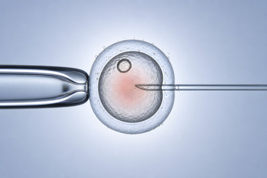 Microscopic ICSI Fertilization Procedure With Human Egg