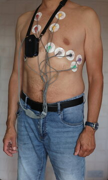 Close-up of an adult man wearing a portable Holter ECG monitor with multiple adhesive electrodes attached to the chest.