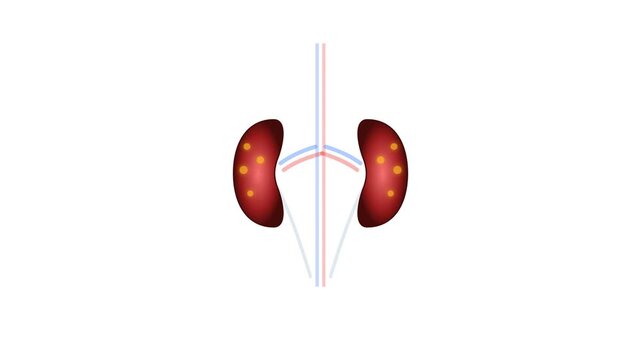 Illustration showing the effects of dehydration on kidneys