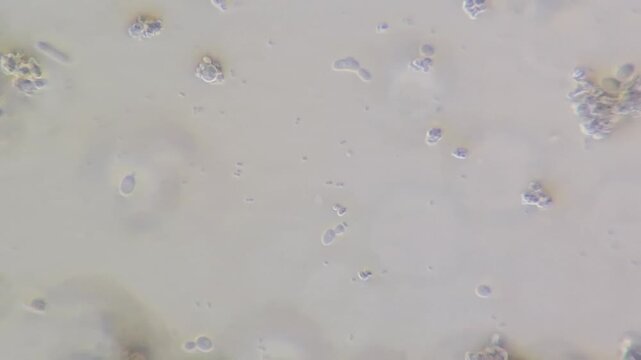 Microscopic view of yeast contamination in cream cheese, budding yeast cells under microscope close up
