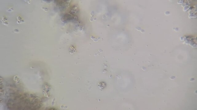 Microscopic view of yeast contamination in cream cheese, budding yeast cells under microscope close up