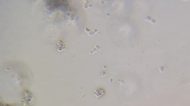 Microscopic view of yeast contamination in cream cheese, budding yeast cells under microscope close up