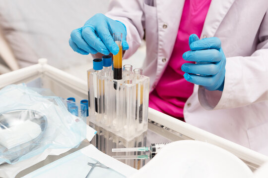 Plasma in test tube. Blood drawn from patient with Serum separate in chemistry laboratory. Lab technician holding test tube of blood sample after being centrifuged