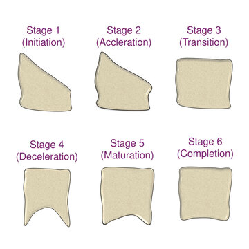 Cervical vertebral maturation stages CVMI infographic for orthodontic skeletal growth assessment