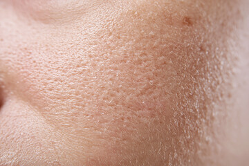 Fototapeta premium Close up macro of slightly dry facial skin with visible pores, fine vellus hair and subtle flaking, warm natural tone conveying texture and gentle skin dryness
