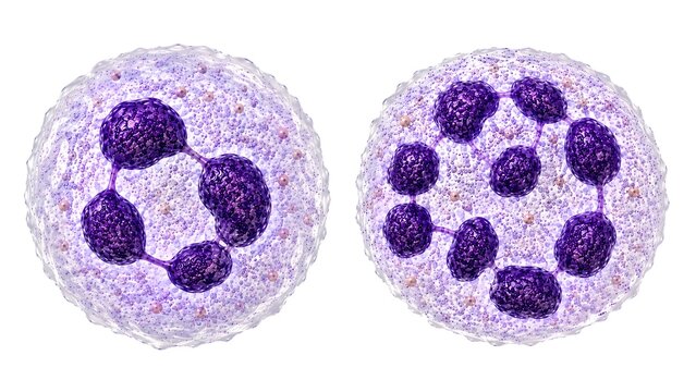 Normal and Hypersegmented Neutrophil Comparison, 3D Medical Illustration