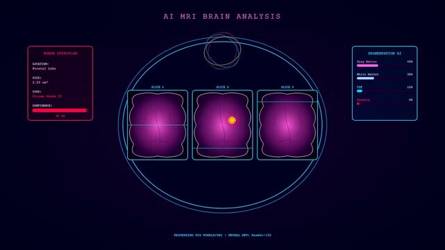 Futuristic motion graphics show AI Medical Diagnostics in use scan brain MRI data identify tumor cells and map neural tissue layers across a digital screen.