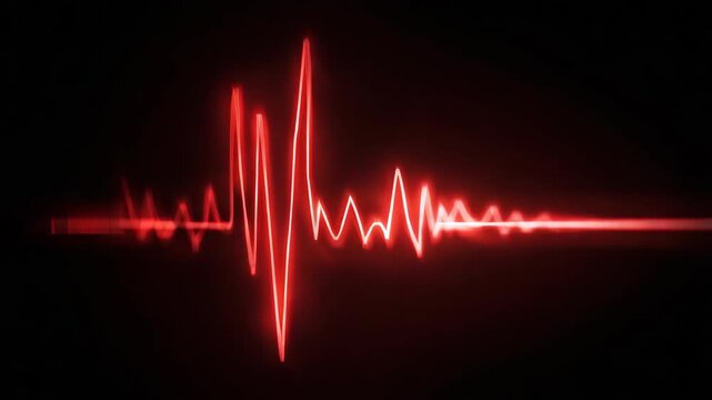 An of an EKG machine screen displaying a heartbeat signal.