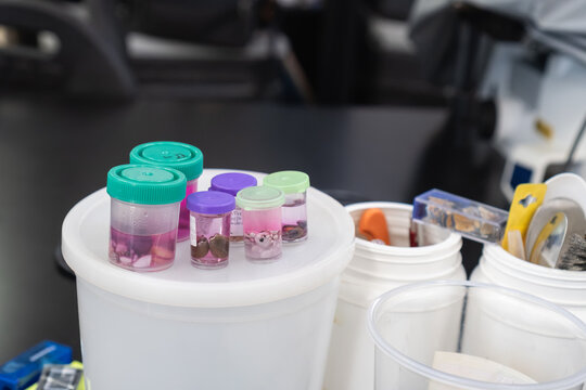Preserving tissue samples in formalin for pathology examination