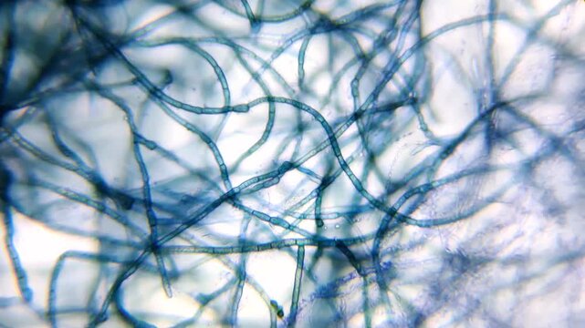 Microscopic view of contaminated Pleurotus djamor mycelium hyphae stained with methylene blue
