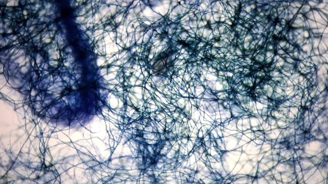 Microscopic view of contaminated Pleurotus djamor mycelium hyphae stained with methylene blue