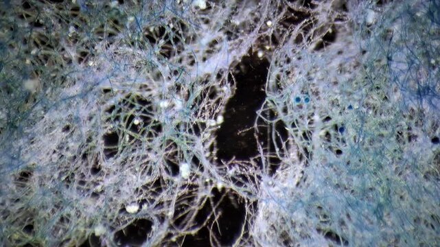 Microscopic view of contaminated Pleurotus djamor mycelium hyphae stained with methylene blue