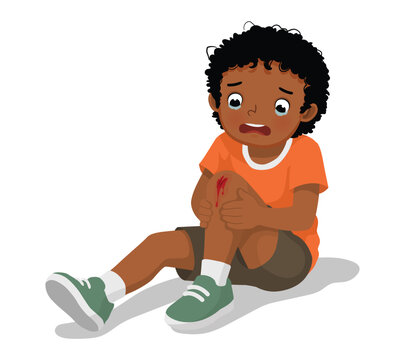 Little African boy has knee injury after falling down scratching his knee bleeding