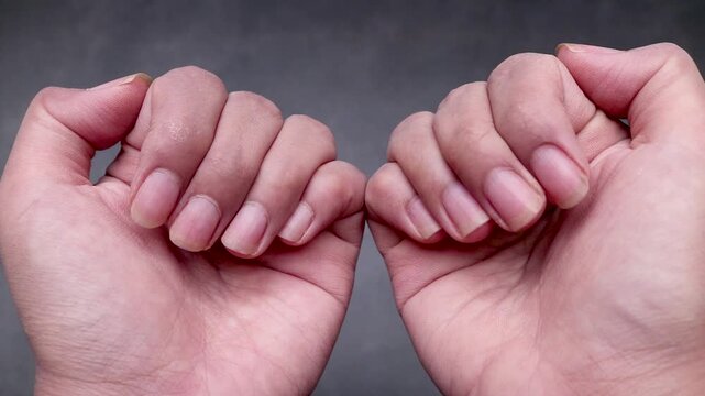 Close up detail of a woman's hand showing long, uncut, dry, and dirty fingernails, isolated on gray background.
