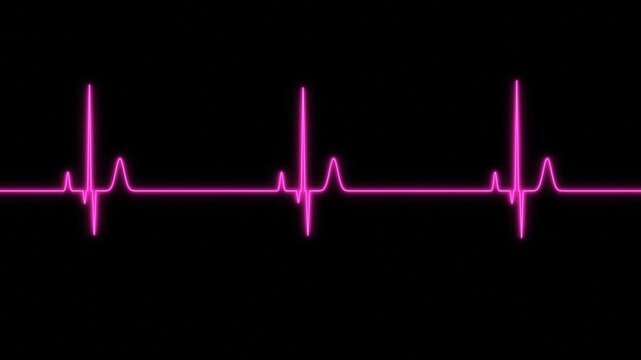 Neon Pink Heartbeat EKG Pulse Line Waveform Display on a Solid Black Background