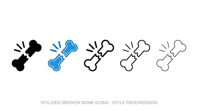 Broken bones arranged horizontally, gradient progression from solid to faint outline, stylized representation of fracture, injury, healing, medical symbolism.