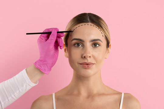 Womans forehead marked with dashed line by gloved hand holding pencil, showing cosmetic forehead lift procedure outline on pink background