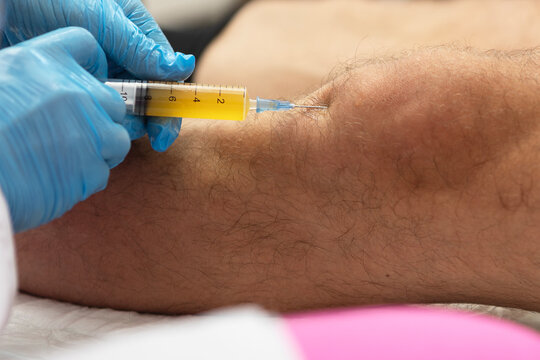 Plasma therapy for joints. Doctor injects plasma into the man's knee. Patient's own biomaterial. Treatment of joint pain without surgery. Regeneration of cartilage