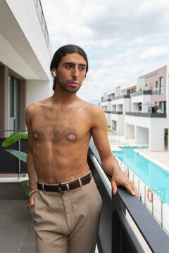 Middle Eastern man with vitiligo standing on balcony