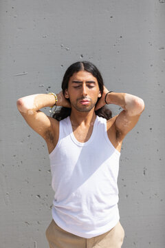 Middle Eastern man with vitiligo resting in sunlight