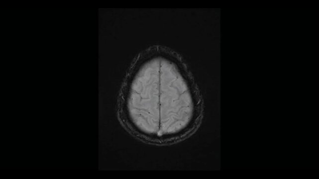 Grayscale MRI brain scan animation in axial projection. Seamless medical loop concept for healthcare, scientific analysis, and neurological diagnostics.