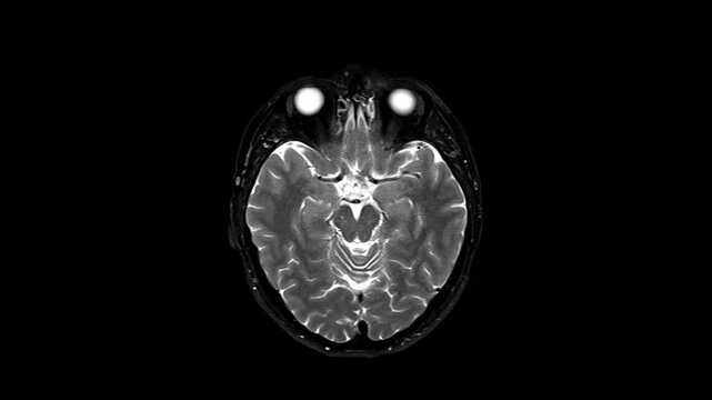 Axial brain MRI scan visualization tracking internal cerebral structures. High tech diagnostic display animation for neurology and healthcare concept video.