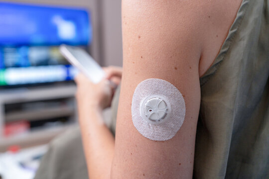 Bare upper arm wearing a white glucose monitor sensor while a person checks a smartphone with a television glowing in the background