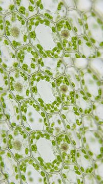 Microscopic view of green plant cells with chloroplasts