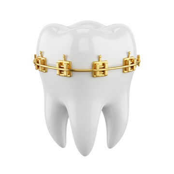 Single anatomically accurate human molar with polished gold braces and metallic archwire isolated on white background premium orthodontic care concept