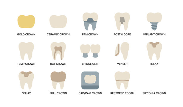 Dental crown icons showing different restoration types in grid