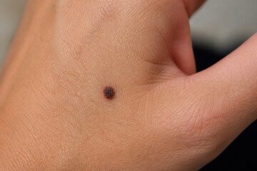 Fototapeta premium A close-up of a person's hand displaying a small dark mole.