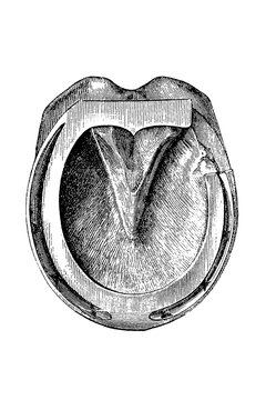 Therapeutic horseshoe with missing fragment over a wound, equine hoof illustration, old vintage illustration, 1889.