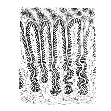 Section through horn and sensitive wall showing contracted heel wall, old vintage illustration, 1889.