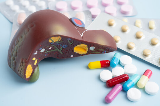 Liver model with pill drug treatment, Cirrhosis, Liver cancer, fatty liver.