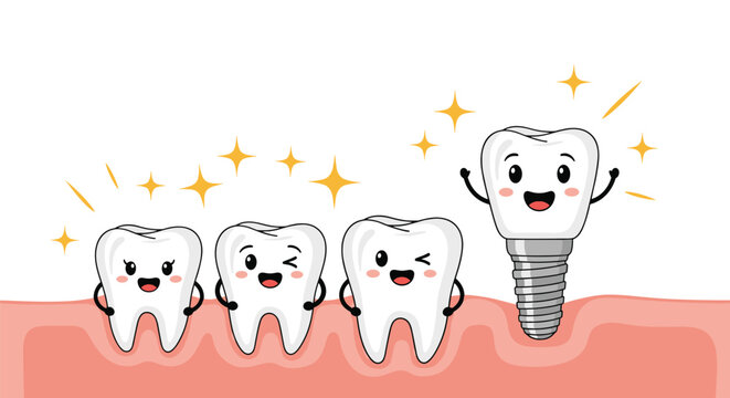 Happy cartoon teeth standing in a row on a pink gum with one tooth proudly showing its dental implant root.